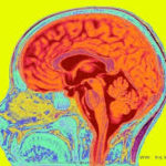 image of cross section of a brain